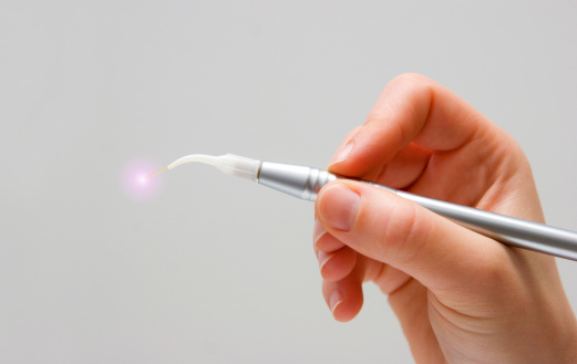 Dentist holding laser tool