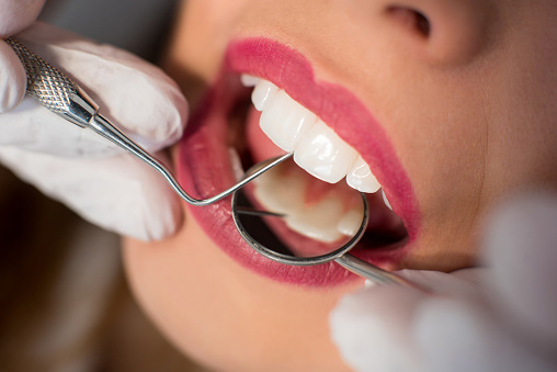 Close up of young woman having dental check up in dental office.