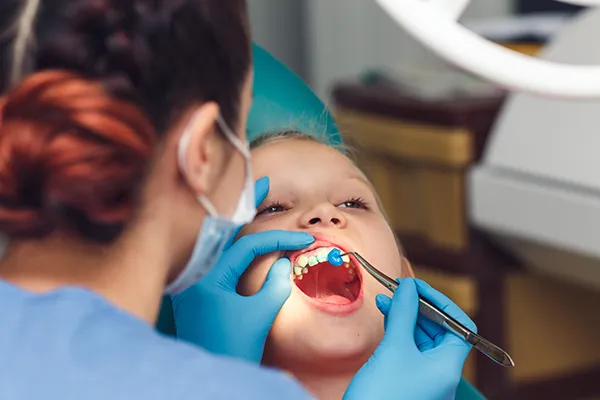 Young white boy patiently keeping his mouth open while his female dental assistant applies fluoride solution to his teeth