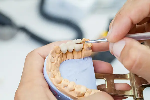 Dental technician working on a custom dental crown in a laboratory using precision tools. 